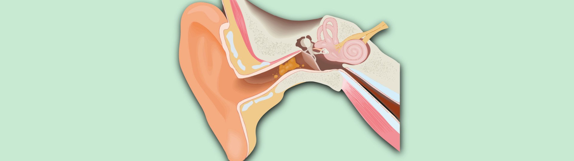 illustration of an ear with ear wax in it