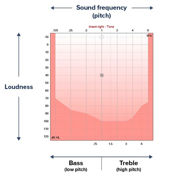 Audiogram showing Sound frequency and Loudness grid