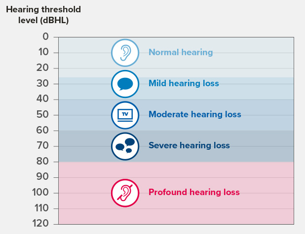 Image show levels of hearing